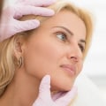 Cosmetic Treatments Services: What You Need to Know