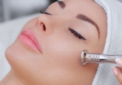 Microdermabrasion: A Comprehensive Overview
